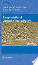 Transplantation of composite tissue allografts