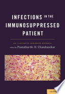 Infections in the immunosuppressed patient : an illustrated case-based approach /