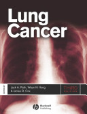 Lung cancer