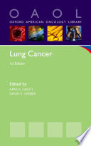 Lung cancer