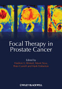 Focal therapy in prostate cancer