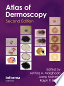Atlas of dermoscopy /