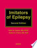 Imitators of epilepsy