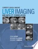 Liver imaging : MRI with CT correlation /