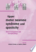 Upper motor neurone syndrome and spasticity : clinical management and neurophysiology /