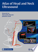 Atlas of head and neck ultrasound /
