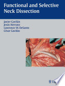 Functional and selective neck dissection