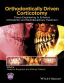 Orthodontically driven corticotomy : tissue engineering to enhance orthodontic and multidisciplinary treatment /