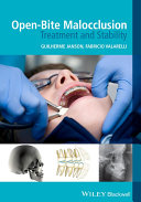 Open-bite malocclusion : treatment and stability /