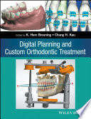 Digital planning and custom orthodontic treatment /