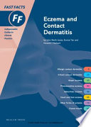 Eczema and contact dermatitis /