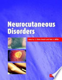 Neurocutaneous disorders