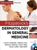 Fitzpatrick's dermatology in general medicine, 8e