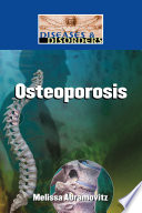 Osteoporosis /