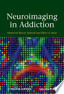 Neuroimaging in addiction