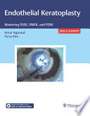 Endothelial keratoplasty : mastering DSEK, DMEK, and PDEK /