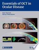 Essentials of OCT in ocular disease /