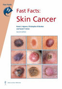 Skin cancer /