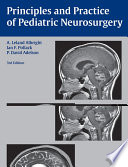 Principles and practice of pediatric neurosurgery /