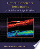 Optical coherence tomography principles and applications /