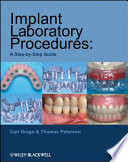 Implant laboratory procedures a step-by-step guide /