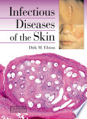 Infectious diseases of the skin