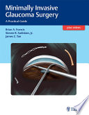 Minimally invasive glaucoma surgery : a practical guide /