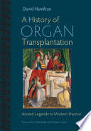 A history of organ transplantation : ancient legends to modern practice /