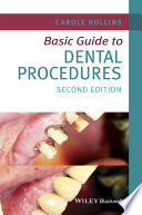 Basic guide to dental procedures /