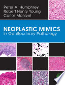 Neoplastic mimics in genitourinary pathology /