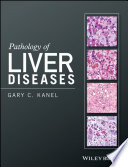 Pathology of liver diseases /