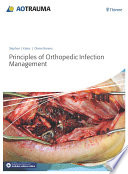 Principles of orthopedic infection management /