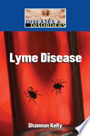 Lyme disease /