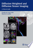 Diffusion weighted and diffusion tensor imaging : a clinical guide /