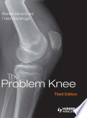 The problem knee : diagnosis and management in the younger patient /