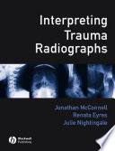 Interpreting trauma radiographs
