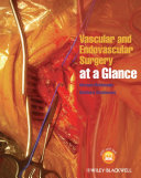 Vascular and endovascular surgery at a glance /