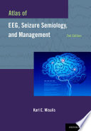 Atlas of EEG, seizure semiology, and management /