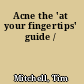 Acne the 'at your fingertips' guide /