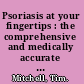 Psoriasis at your fingertips : the comprehensive and medically accurate manual on managing psoriasis /