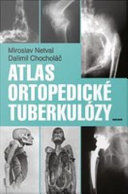 Atlas ortopedické tuberkulózy /