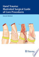 Hand trauma : illustrated surgical guide of core procedures /