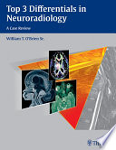 Top 3 differentials in neuroradiology : a case review /