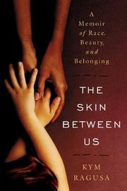 The skin between us : a memoir of race, beauty, and belonging /