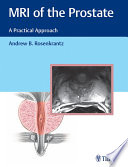 MRI of the prostate : a practical approach /