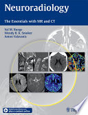 Neuroradiology : the essentials with MR and CT /