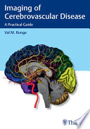 Imaging of cerebrovascular disease : a practical guide /