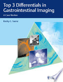 Top 3 differentials in gastrointestinal imaging : a case review /