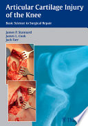 Articular cartilage injury of the knee : basic science to surgical repair /