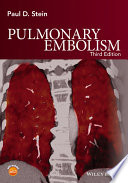 Pulmonary embolism /